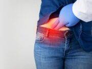 Blindtarmbetennelse Betennelse i blindtarmen